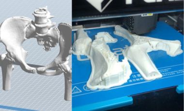 Innovations in 3D Bioprinting Techniques