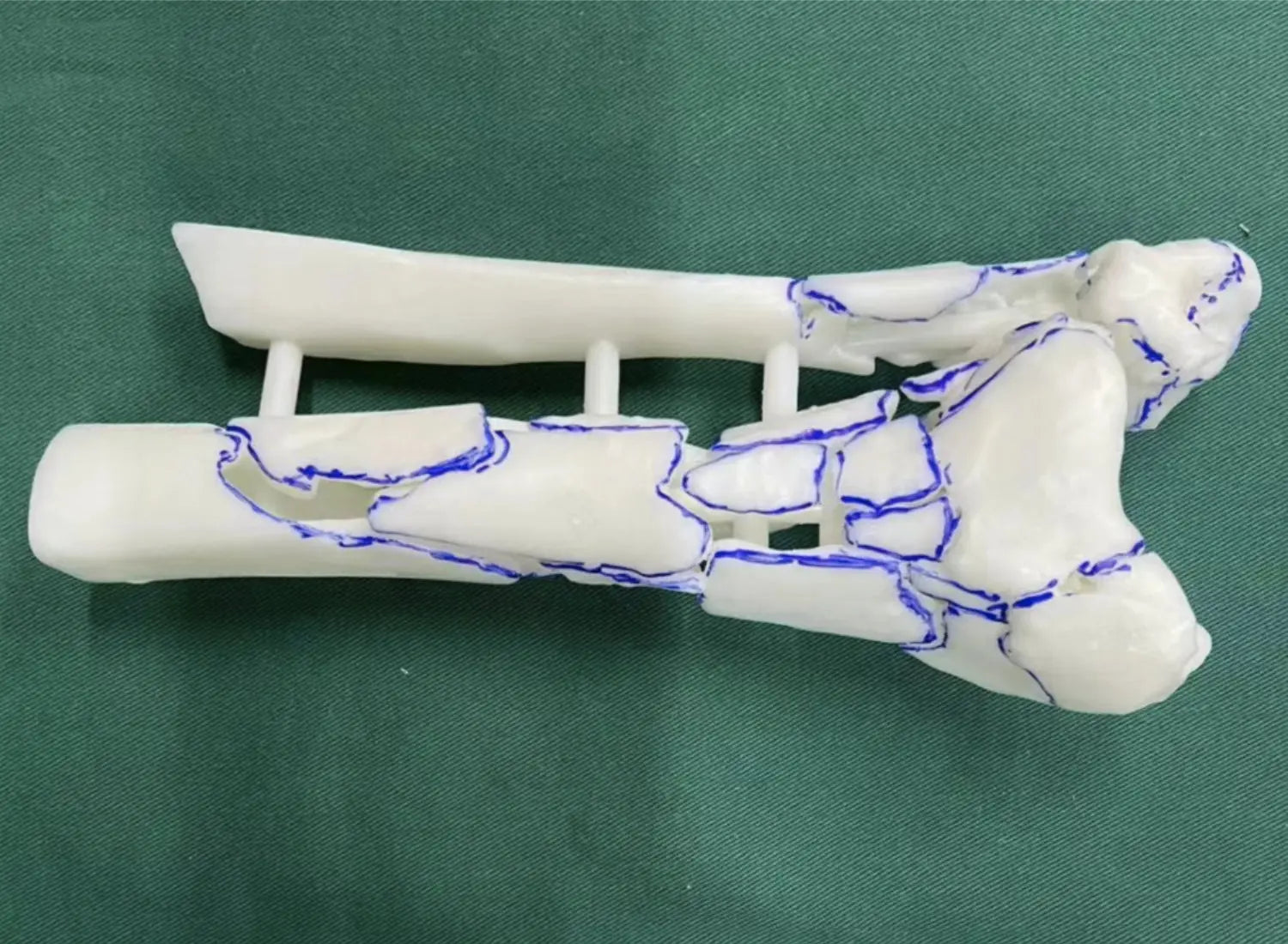 Innovative-Applications-of-3D-Printing-Simulators-in-Surgical-Training Flashforge